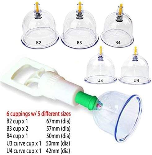 Vákuumos Köpölyöző Készlet